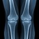 normal knee X-ray